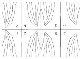 End or Butt Matching Illustration